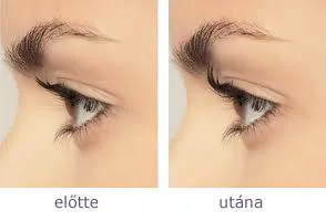 Szempilla dauer: előtte és utána